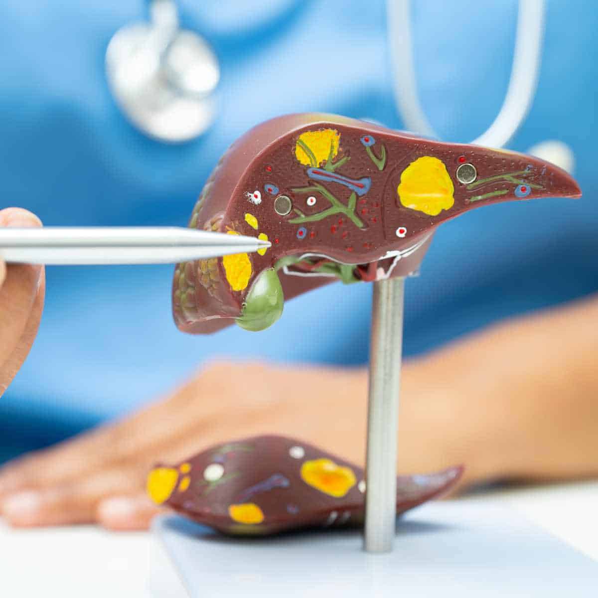 The Link Between Fatty Liver Disease and Type 2 Diabetes